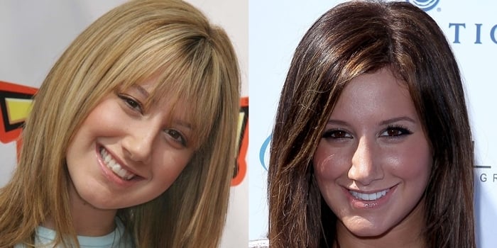 Ashley Tisdale before undergoing rhinoplasty in 2004 (left) and after her nose surgery in 2010 (right)