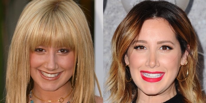 Ashley Tisdale before her rhinoplasty procedure in 2005 (left) and showcasing her refined look at a holiday party in December 2019 (right)