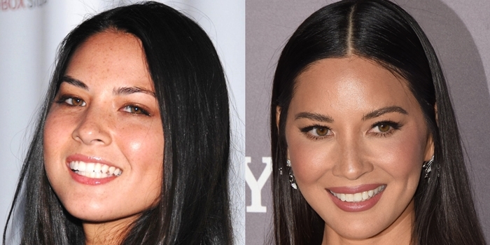 Plastic surgery or skincare? Olivia Munn's face with and without freckles in 2007 and 2019