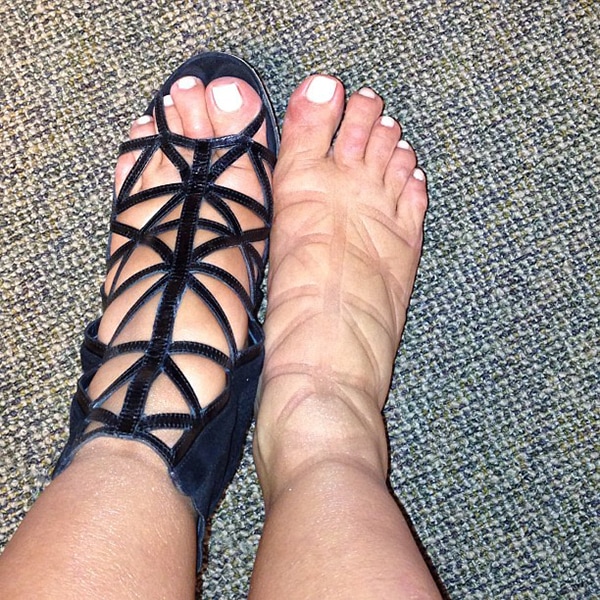 Kim Kardashian's swollen feet