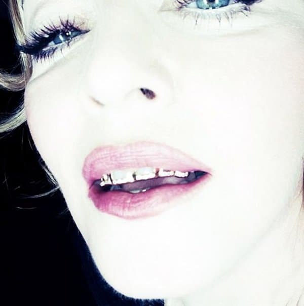 Madonna showcases her new diamond-studded grills on Instagram, captioning "Don't hate me. Hate my #grilz."