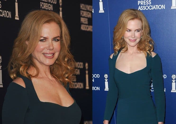 Nicole Kidman's cutout body-fit dress by Narciso Rodriguez