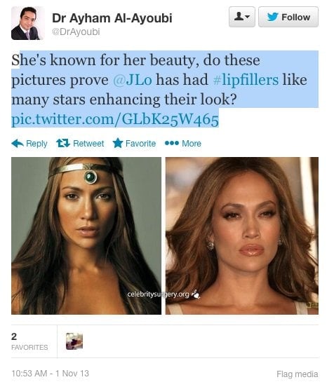 Jennifer Lopez before and after plastic surgery