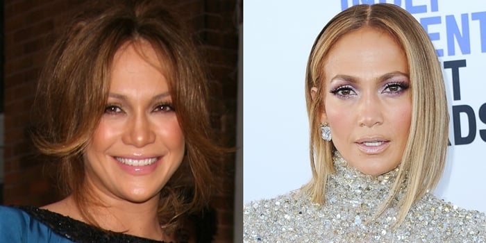 Jennifer Lopez before and after possible plastic surgery