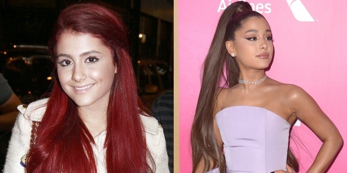 Ariana Grande's face before and after plastic surgery