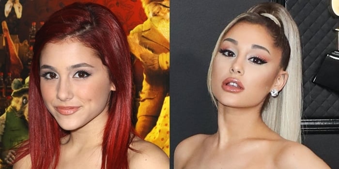 Ariana Grande's face before and after rumored plastic surgery