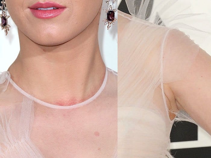 Katy Perry's tight neckline caused redness on her neck, and the restrictive sleeves tore the armhole of her dress at the Grammy Awards