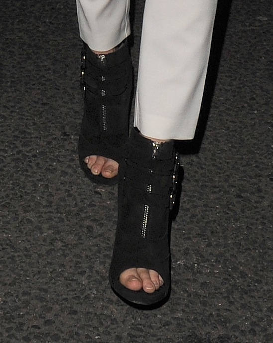 Cara Delevingne's jacked up toes