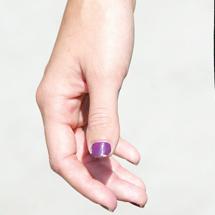 A forma dos polegares da Megan Fox é devido a uma condição chamada braquidactilia's thumbs is due to a condition called brachydactyly