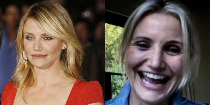 Cameron Diaz before and after plastic surgery