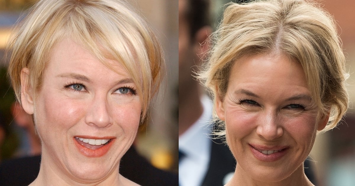 Renee Zellweger's Face Before And After Plastic Surgery