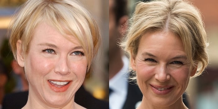 Before and after plastic surgery? Renee Zellweger in 2008 and 2019