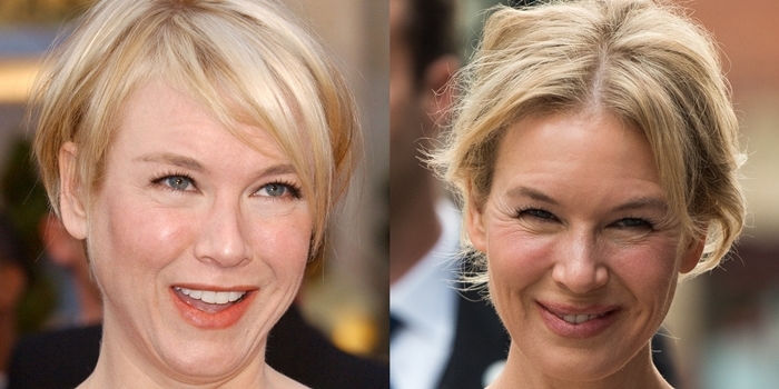 Before and after plastic surgery? Renee Zellweger in 2008 and 2019