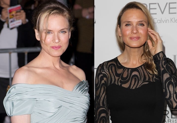 Renee Zellweger before and after