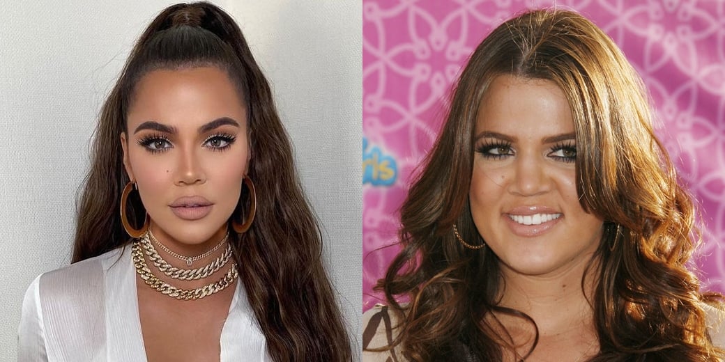 Khloé Kardashian's nose before and after