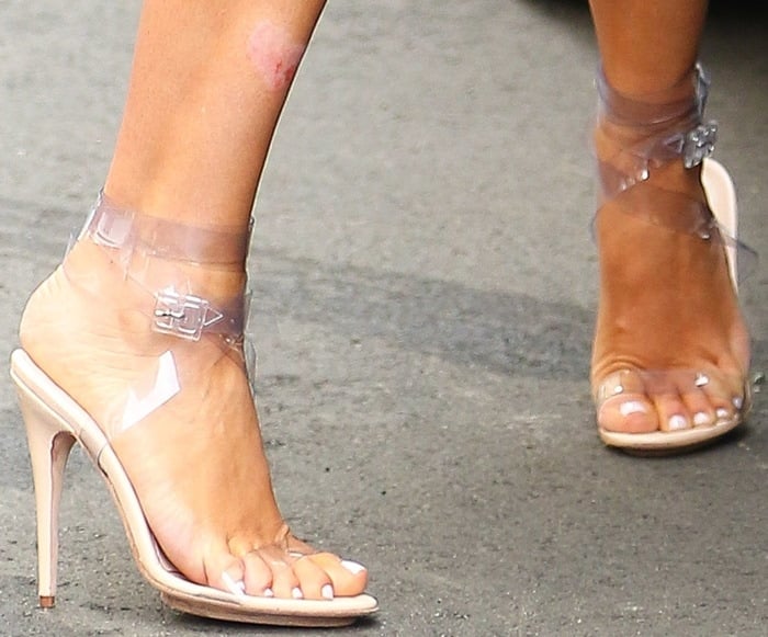 Kim Kardashian suffers from psoriasis and has several skin rashes