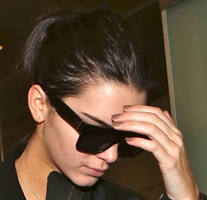 Kendall Jenner shields her face with sunglasses, revealing noticeable pimples and acne along her jawline and chin at Los Angeles International Airport (LAX) on January 2, 2015