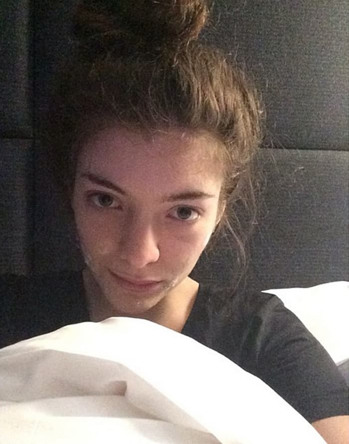 Lorde, like most 17-year-olds, experiences the common teenage issue of acne, and the Grammy Award-winning singer shared a bare-faced selfie on Instagram, showcasing herself in bed in Paris with acne cream on her face