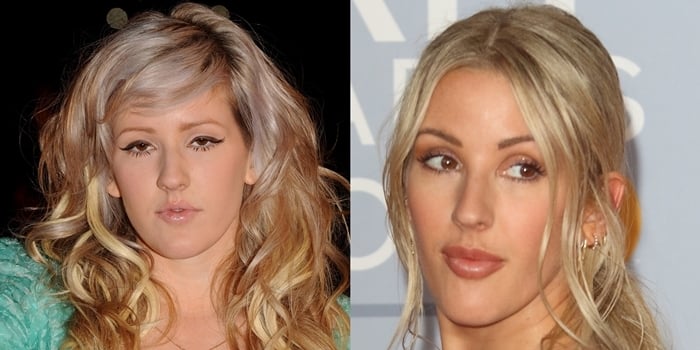 Ellie Goulding's face in February 2010 (L) and in February 2020 (R)