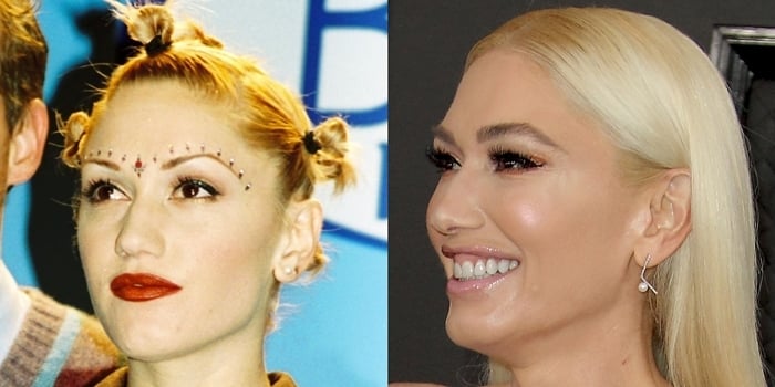 Before and After: Gwen Stefani's face at the 1997 Billboard Music Awards (L) and the 2020 Grammy Awards (R)