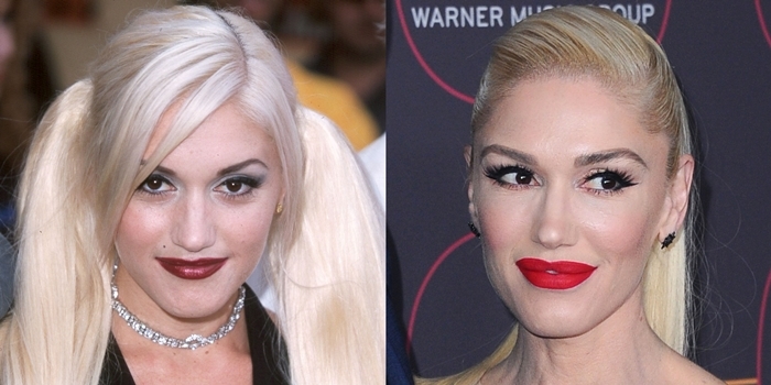 Gwen Stefani's lips at the 2001 MTV Movie Awards (L) and at the Warner Music Group Pre-Grammy Party in 2020 (R)