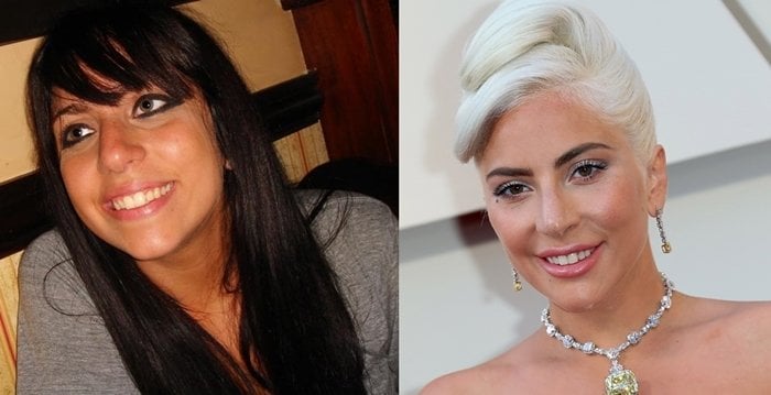 Before and after rumored plastic surgery: Lady Gaga pictured in 2006 (L) and 2019 (R)