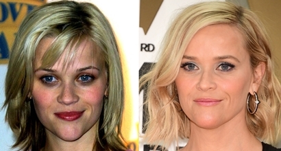 Reese Witherspoon's Plastic Surgery: Chin Before And After