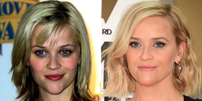 Reese Witherspoon Chin (reese, witherspoon, chin, 2015 Baby2Baby Gala presented) Reese Witherspoon before and after chin reduction plastic surgery