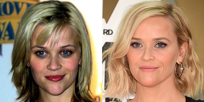 Reese Witherspoon before and after chin reduction plastic surgery