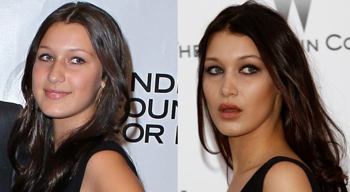 Before and after: Bella Hadid in 2010 (L) and in 2015 (R)