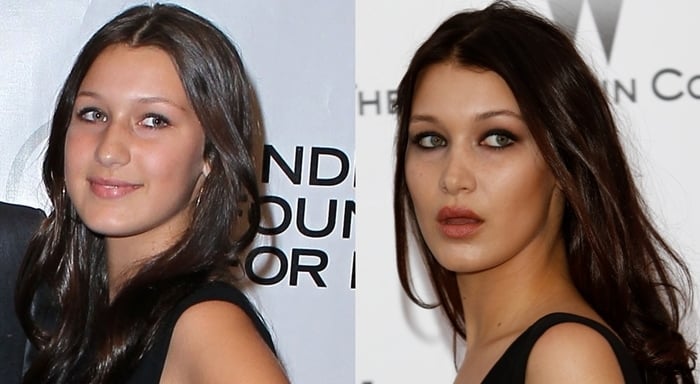 Bella Hadid Before And After Denies Plastic Surgery