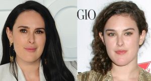 Rumer Willis' Chin Before and After Possible Plastic Surgery