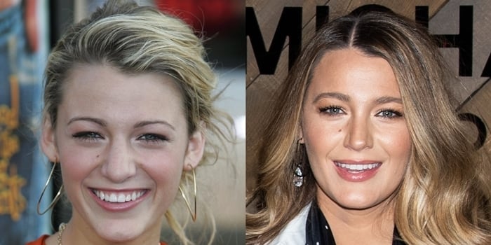 Blake Lively's nose in May 2005 (L) and in February 2020 (R)
