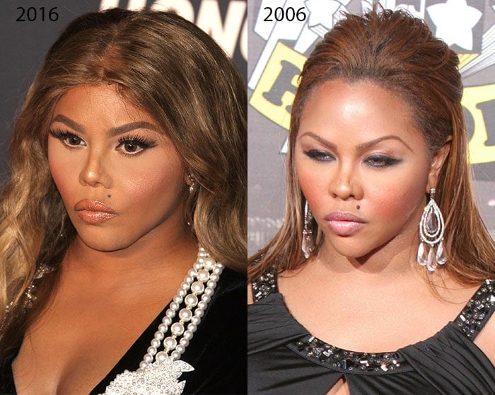 Lil Kim Before After Plastic Surgery What Happened To Her Face