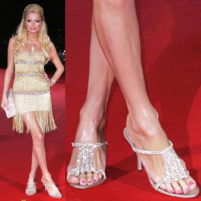 Paris Hilton in sparkly sandals showing her foot bunions