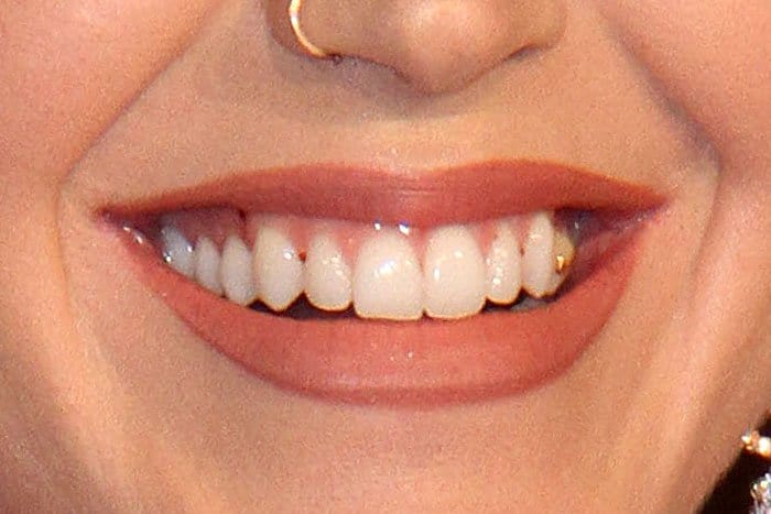 Katy Perry with a piece of gold Nike Swoosh teeth jewelry on her left premolar