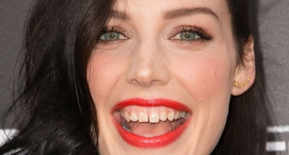 Jessica Paré’s Famous Tooth Gap: How It Became Her Signature Look