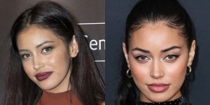 Cindy Kimberly Denies Nose Job: Face Before/After Plastic Surgery
