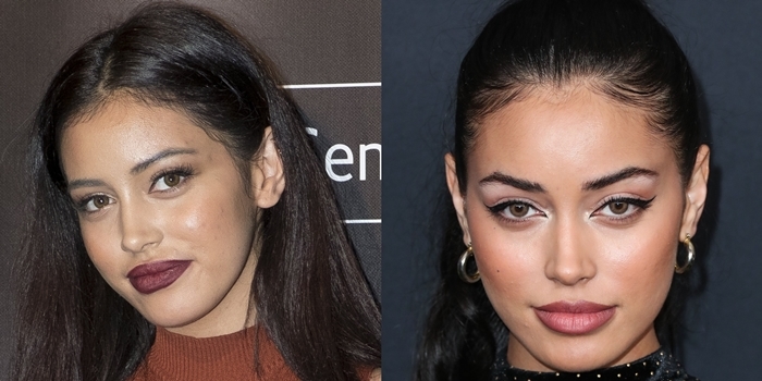 Cindy Kimberly's face in February 2016 (L) and in January 2020 (R)