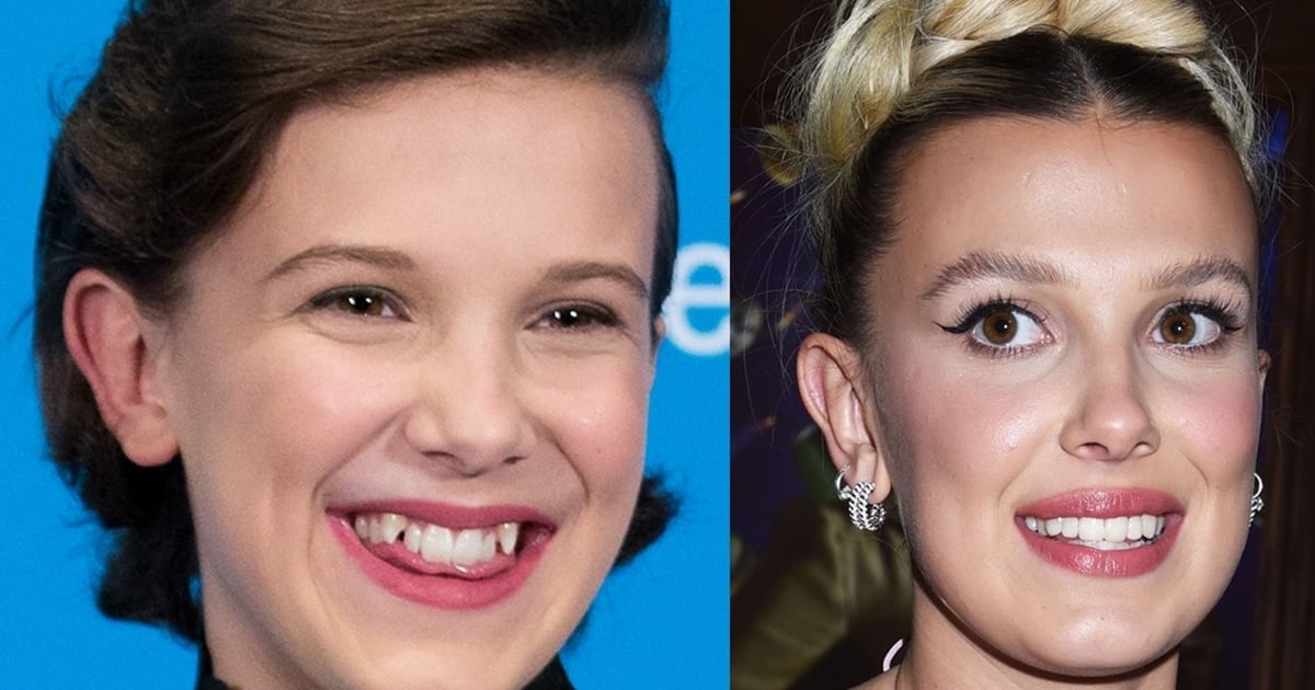 Millie Bobby Brown Flashes Fixed Teeth And Makes Funny Faces