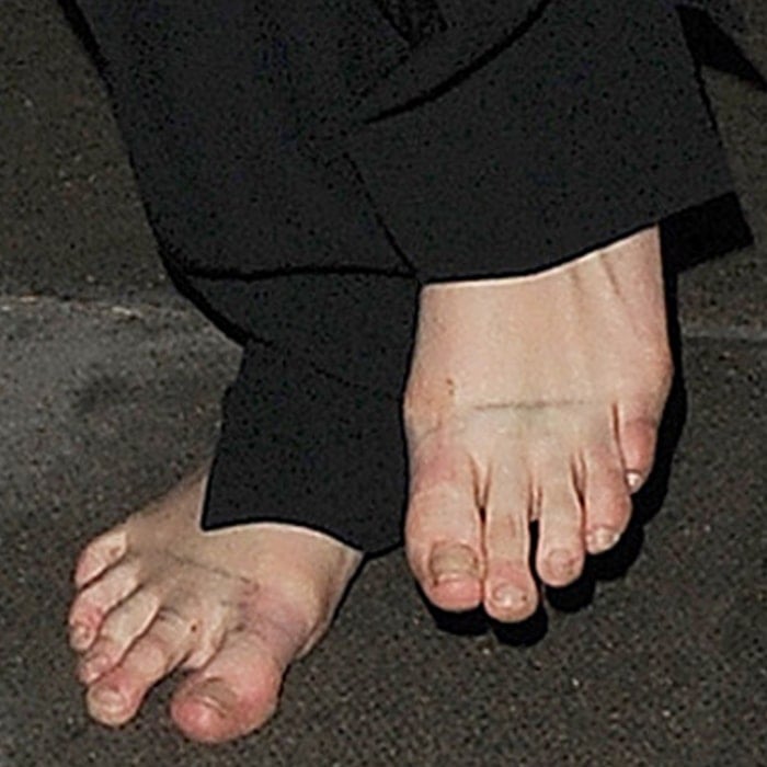 Cara Delevingne shows off her nasty finger toes