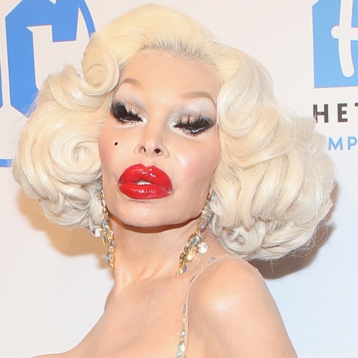 Does Amanda Lepore have the biggest lips in the world?