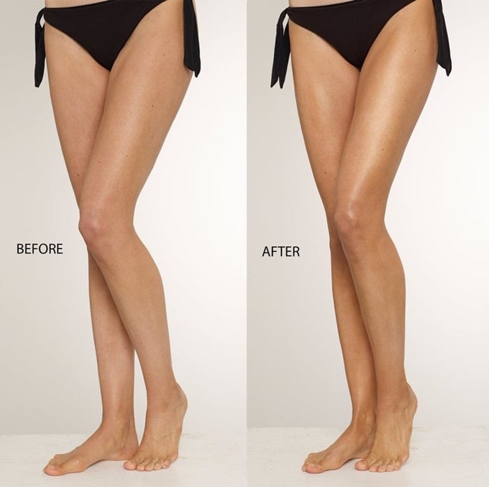 ThisWorks Perfect Legs Skin Miracle Before and After