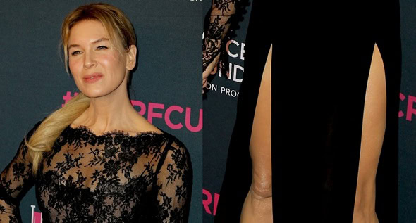 Rene Zellweger Shows Off Thigh Slits and Classic Stilettos at 2020 Women's Cancer Research Fund Rene Zellweger Shows Off Thigh Slits and Classic Stilettos at 2020 Women's Cancer Research Fund