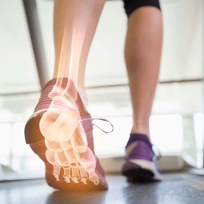 Spenco insoles help protect the interior of your foot, which contains 26 bones, 33 joints, and more than a hundred muscles, tendons, and ligaments