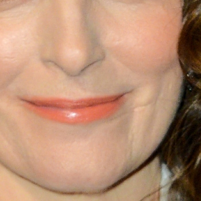 Tina Fey has a thin scar on the left side of her face