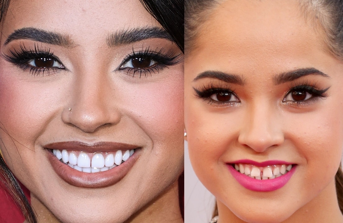 Becky G shows off her fixed teeth in 2023 (L) and her iconic tooth gap in 2014 (R)