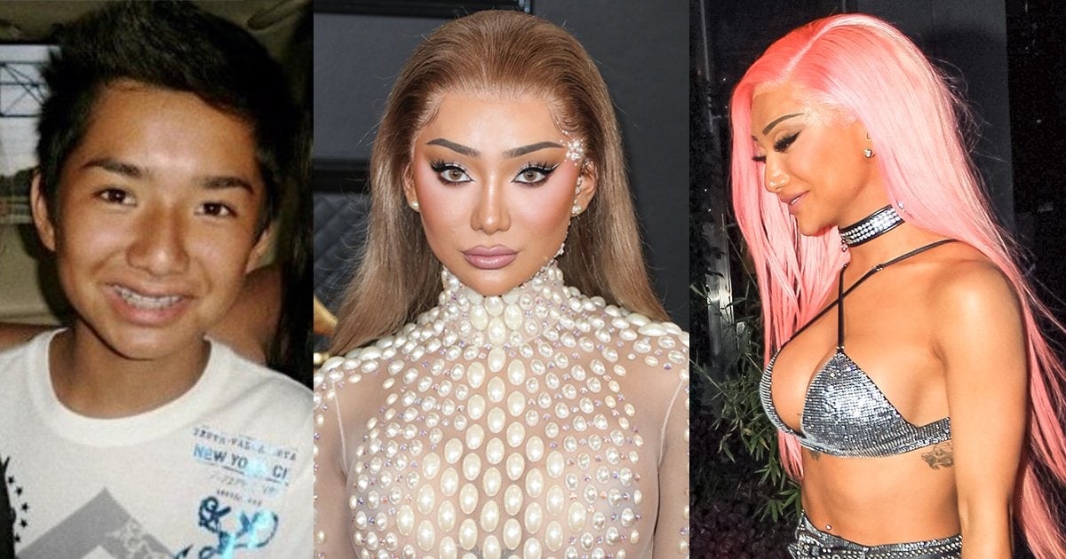 Nikita Dragun's Plastic Surgery: Before and After On Instagram.