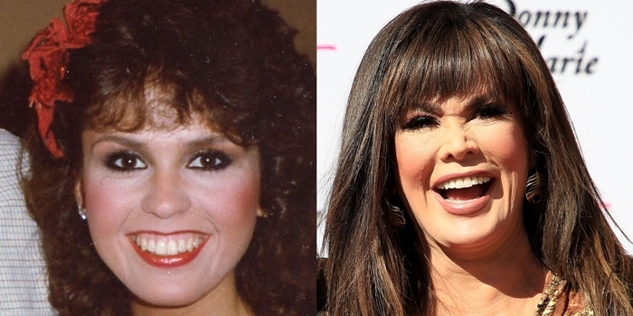 Face before and after rumored plastic surgery: Marie Osmond in 1982 (L) and in 2020 (R)