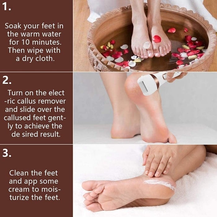 How to use an electric foot callus remover
